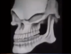 skull